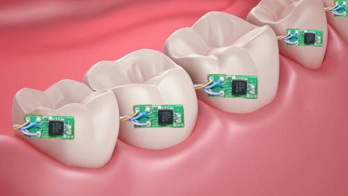 دندانهای دیجیتال