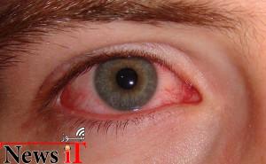 حل مشکل خشکی چشم با ایمپلنتی به شکل وایرلس